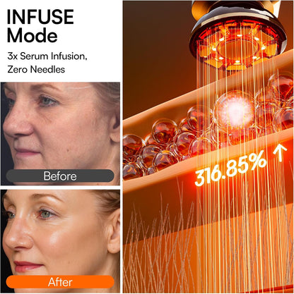 INIA FLARE 3-in-1 Red Light Therapy Beauty Device for Face & Neck White