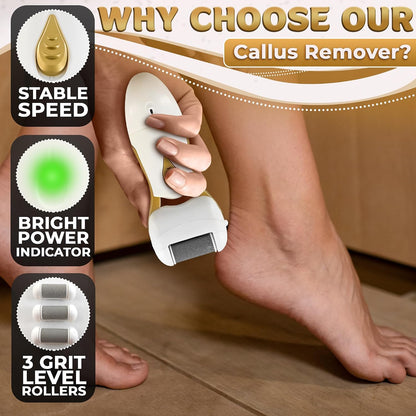 Battery Operated Foot Callus Remover for Dead Skin, Exfoliating Tool