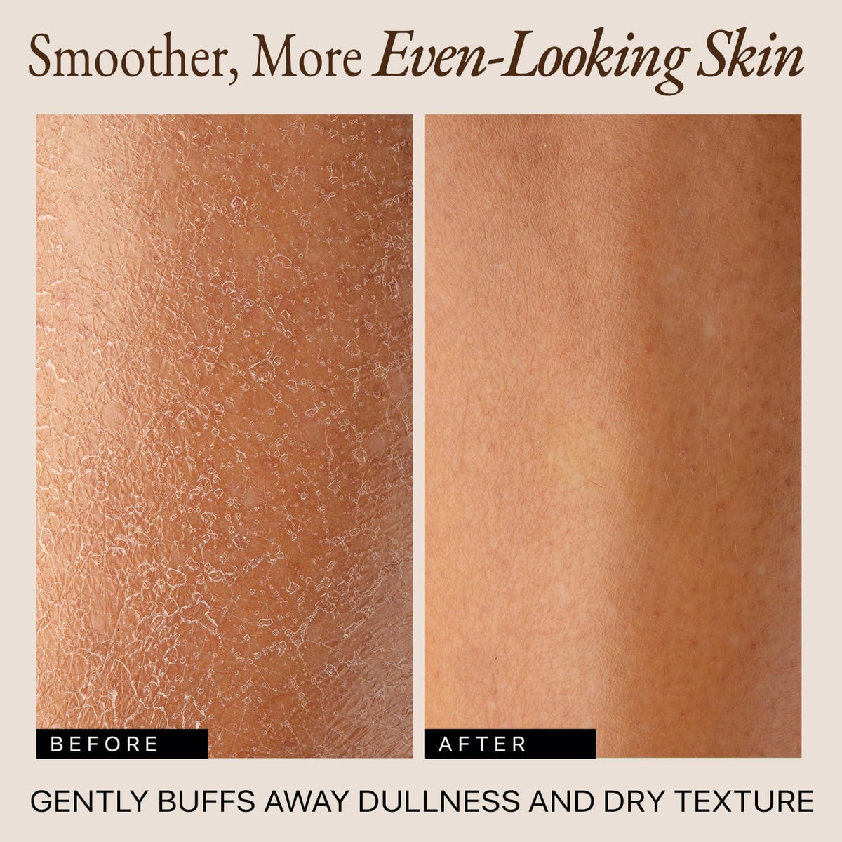 Dry Brushing Body Brush for Lymphatic Drainage & Cellulite