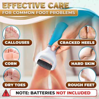 Battery Operated Foot Callus Remover for Dead Skin, Exfoliating Tool