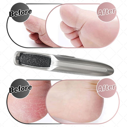 Powerful Electric Callus Remover Wand – Rechargeable Foot File, Grinder & Scrubber - Removes Dead, Hard Skin & Calluses – Best Pedicure Tool for Soft, Smooth Feet for Men & Women (Rose Gold)