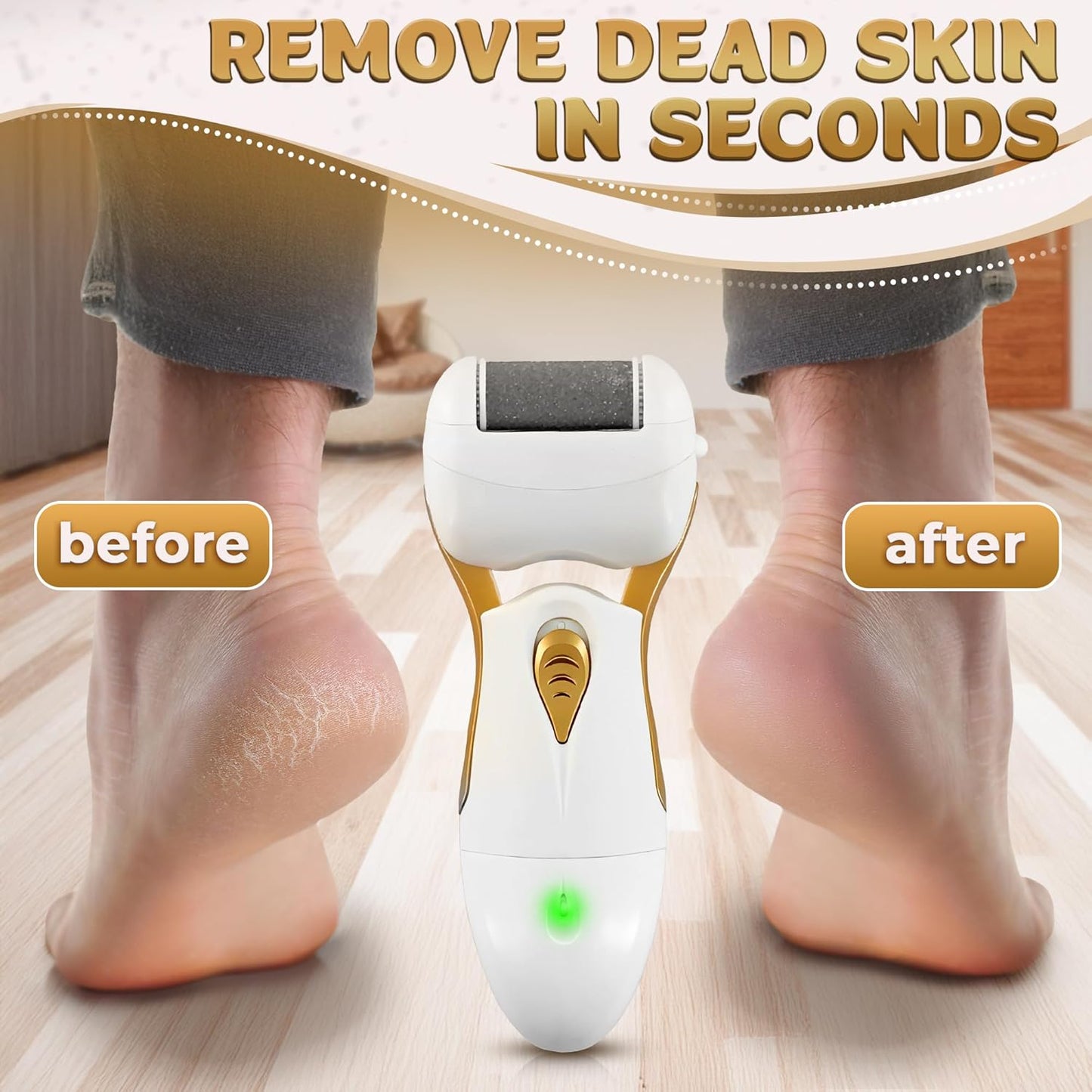 Electric Foot Callus Remover Tool for Dead Skin & Cracked Heels – Battery-Operated Foot Grinder with Replaceable Roller – Pedicure Tools for Feet & Toes – Smooth Feet at Home (Batteries Not Included)