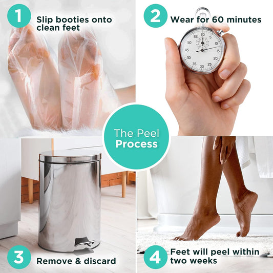 DERMORA Foot Peel Mask - Exfoliating Foot Peeling Mask for Dry, Cracked Feet, At-Home Spa Care, Callus Removal & Smoother Skin Result, 2 Pairs Regular Size (Fits up to Woman 11, Men 10) Original Scent