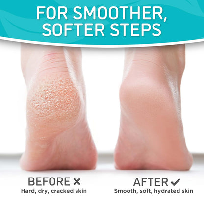 Dermora Soft Touch Foot Peel Mask - Pack of 2 Feet Peeling Masks for Dry, Cracked Heels & Calluses - Exfoliating Foot Mask Peel for Baby Soft Skin (Original)