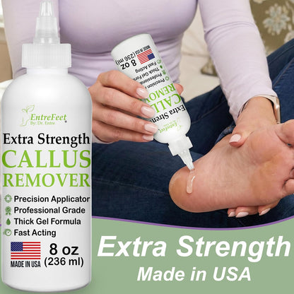 Dr. Entre's Callus Remover Gel & Foot File: Extra Strength Callus Remover for Feet, Foot Callus Remover Care, Pedicure Tools Supplies, Spa Kit, Dead Skin Scrubber, 4 oz