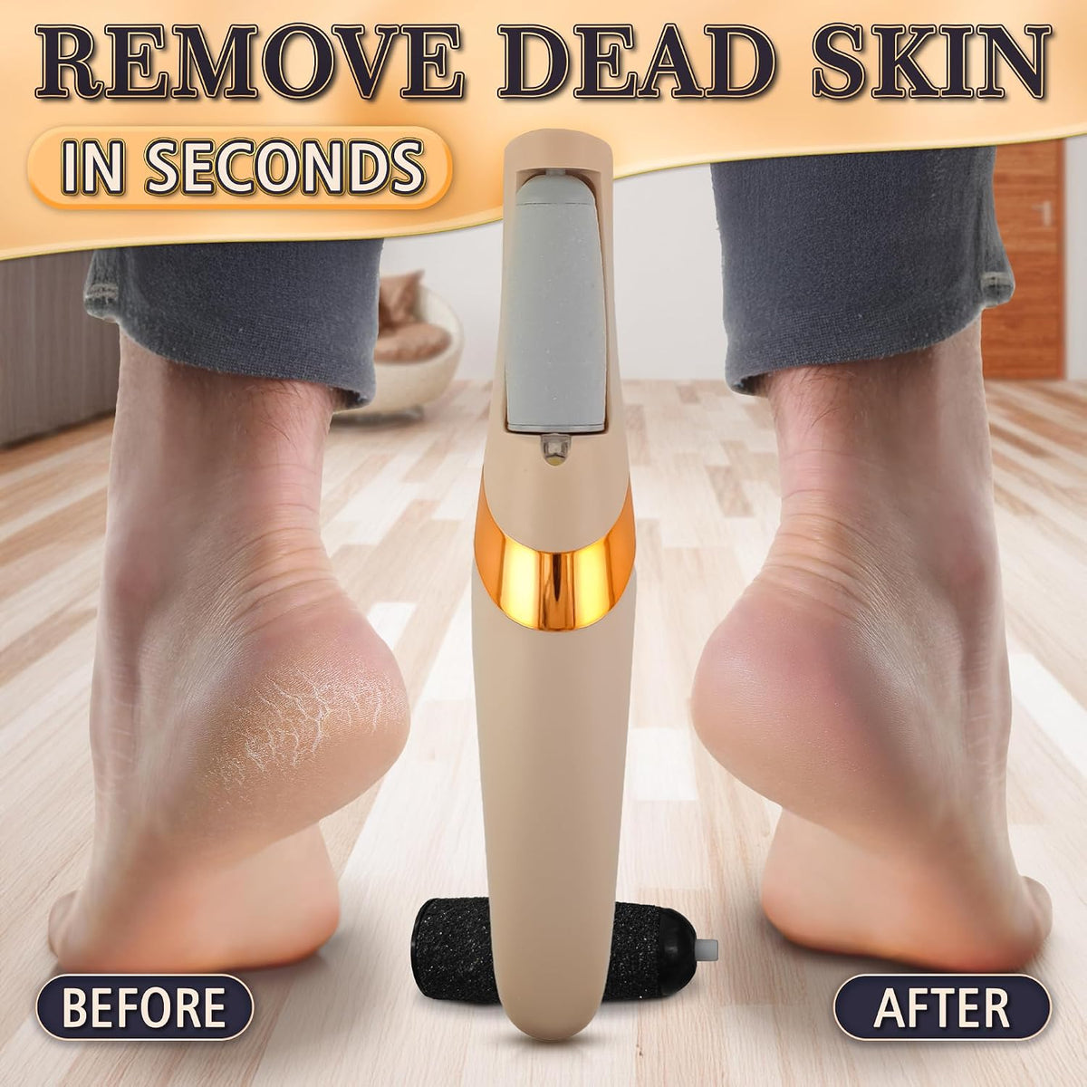 Battery Operated Foot Callus Remover for Dead Skin, Exfoliating Tool