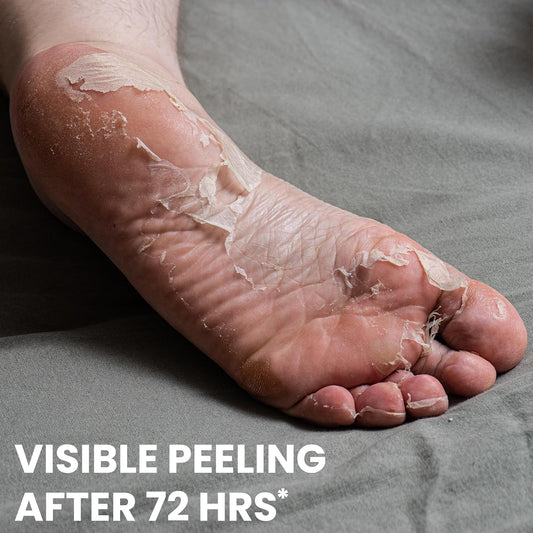 One's Own Korean Exfoliating Foot Peeling Mask, Moisturizing Foot Mask for Dry Cracked Feet, Feet Exfoliator to Peel Off Dead Skin & Callus Removal for Baby Soft Skin, Cruelty-Free & Safe, 2 Pair